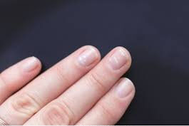 white spot on nails